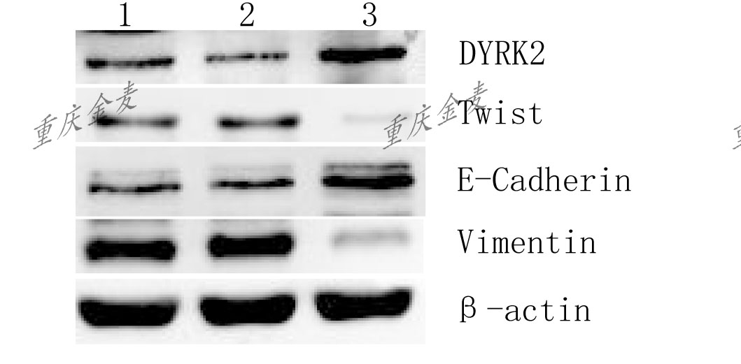 Western Blotting